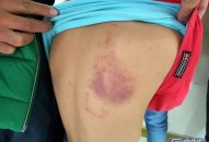 Đình chỉ dạy 1 tháng đối với cô giáo đánh Qq88 https betamed sa com lớp 2 bầm lưng