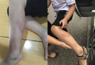Đình chỉ cô giáo đánh Qq88 https betamed sa com lớp 2 vì làm bài chậm