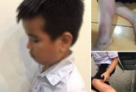 Vụ cô giáo đánh Qq88 https betamed sa com vì làm bài chậm: Đình chỉ dạy 6 tháng