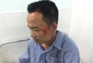 Người dân tố bị côn đồ hành hung sau khi xô xát với giám đốc QUÀ TẶNG QQ88 | Ho Chi Minh City
