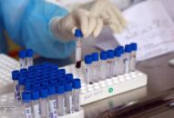Thêm 2 ca khỏi, 96% ca mắc COVID-19 ở Việt Nam đã bình phục