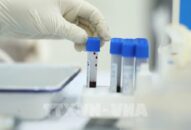 Xét nghiệm SARS-CoV-2 cho người có nhu cầu xuất cảnh