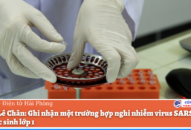 Quận Lê Chân: Ghi nhận một trường hợp nghi nhiễm virus SARS-CoV-2 là Qq88 https betamed sa com lớp 1