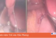 Cảnh báo tình trạng thủng dạ dày ở QQ8827 website cá cược trực tuyến trong thời gian dịch SARS-CoV-2 bùng phát